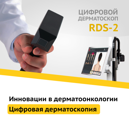 Цифровой анализ новообразований кожи на инновационном оборудовании экспертного класса в ОМНИУС клинике Цифровой анализ новообразований кожи на инновационном оборудовании экспертного класса в ОМНИУС клинике